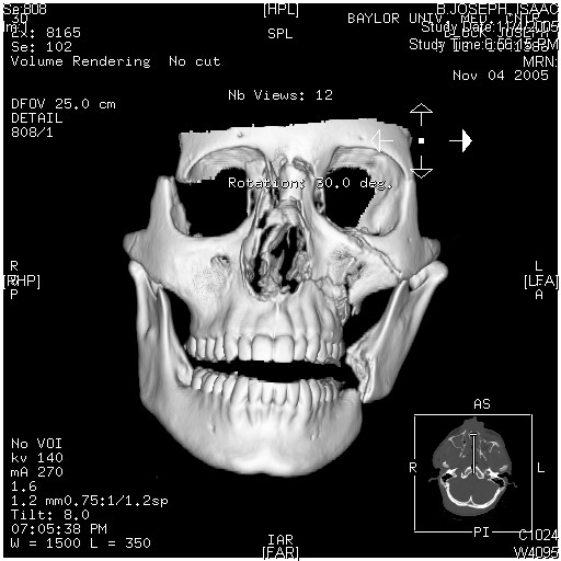 Copy of block - facial fx 3d