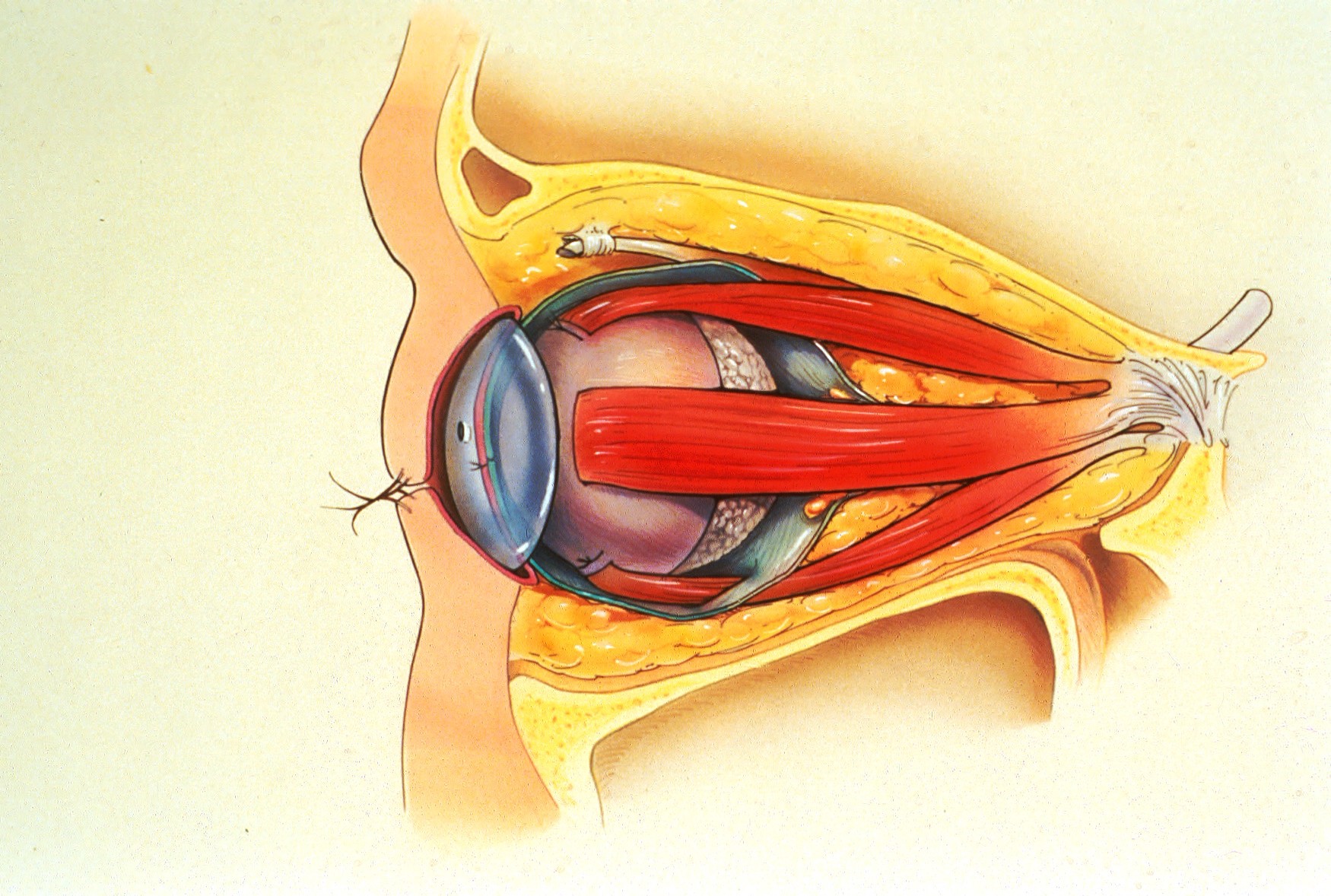 ENUCLEATION (4)