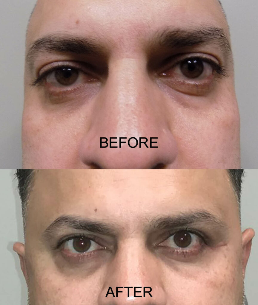 BEFORE AND AFTER 20