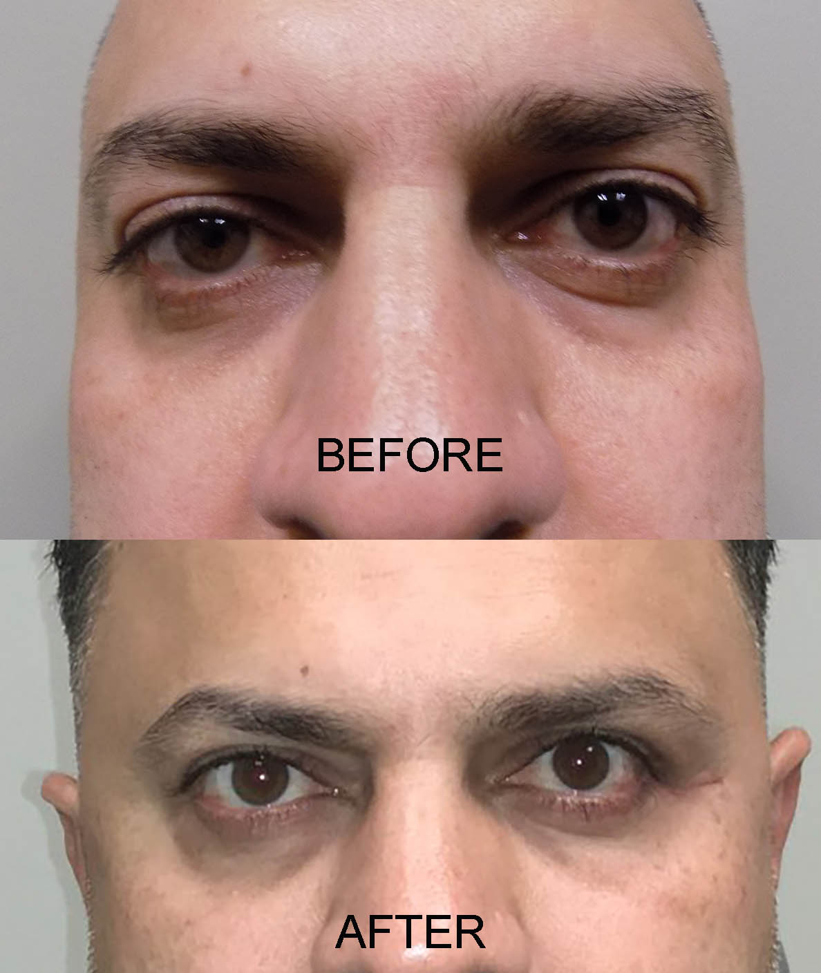 BEFORE AND AFTER 20