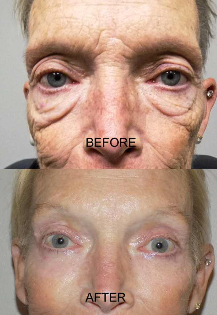 BEFORE AND AFTER 30