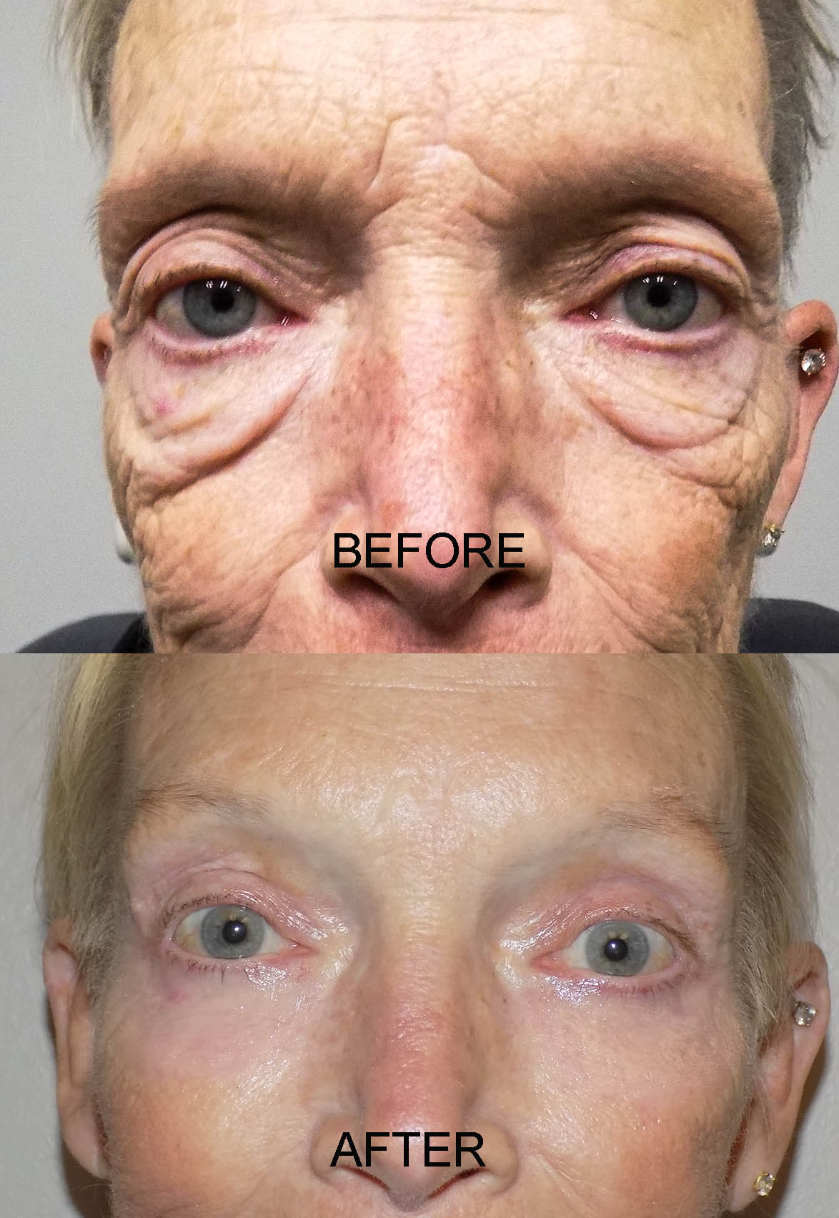 BEFORE AND AFTER 30